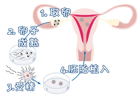 高齢初産